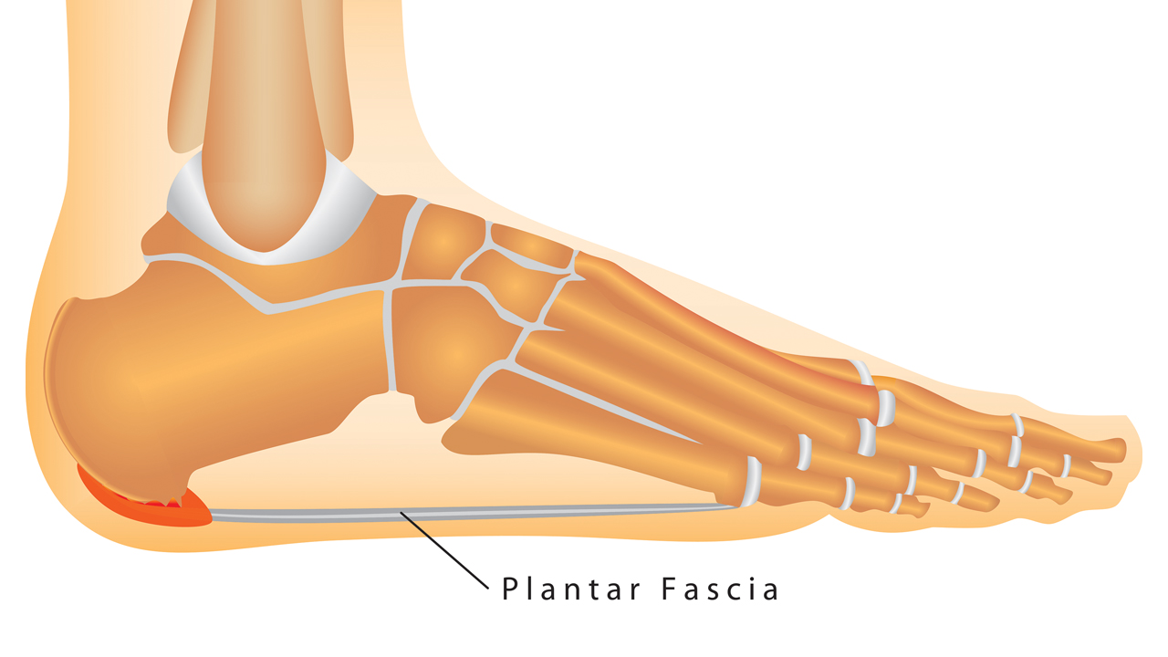 Plantar Fascia Diagram